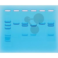 PCR test na COVID-19